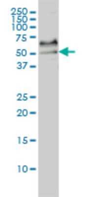 Western Blot: Serum Response Factor SRF Antibody (1C8) [H00006722-M02]