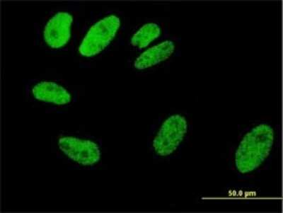 Immunocytochemistry/ Immunofluorescence: Serum Response Factor SRF Antibody (2G2) [H00006722-M01]