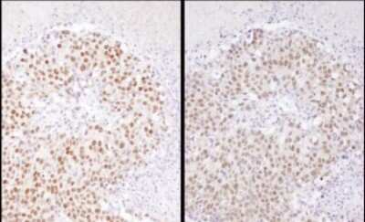 Immunohistochemistry-Paraffin: Serum Response Factor SRF Antibody [NBP1-71927]