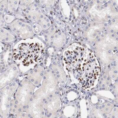 Immunohistochemistry-Paraffin: Serum Response Factor SRF Antibody [NBP1-87814]