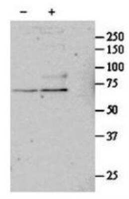 Western Blot: Serum Response Factor SRF Antibody [NBP1-51976]