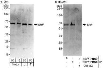 Western Blot: Serum Response Factor SRF Antibody [NBP1-71927]