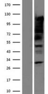 Western Blot: Serum Response Factor SRF Overexpression Lysate [NBP2-10873]