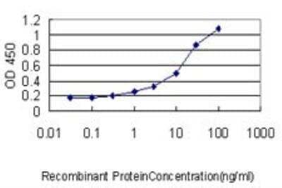 ELISA: Seryl tRNA synthetase Antibody (1H4) [H00006301-M01]