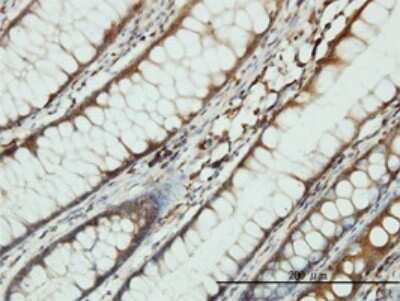 Immunohistochemistry-Paraffin: Seryl tRNA synthetase Antibody (1H4) [H00006301-M01]
