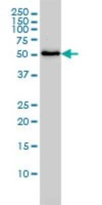 Western Blot: Seryl tRNA synthetase Antibody (1H4) [H00006301-M01]