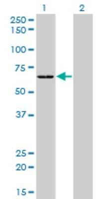 Western Blot: Seryl tRNA synthetase Antibody (1H4) [H00006301-M01]