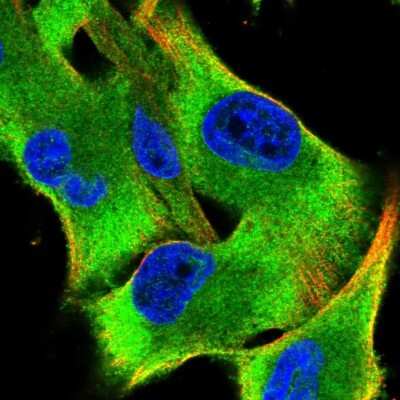 Immunocytochemistry/ Immunofluorescence: Seryl tRNA synthetase Antibody [NBP2-55884]