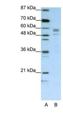 Western Blot: Seryl tRNA synthetase Antibody [NBP1-57538]