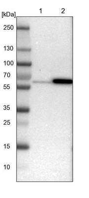 Western Blot: Seryl tRNA synthetase Antibody [NBP1-80765]