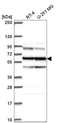 Western Blot: Seryl tRNA synthetase Antibody [NBP2-55884]