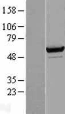 Western Blot: Seryl tRNA synthetase Overexpression Lysate [NBL1-15694]