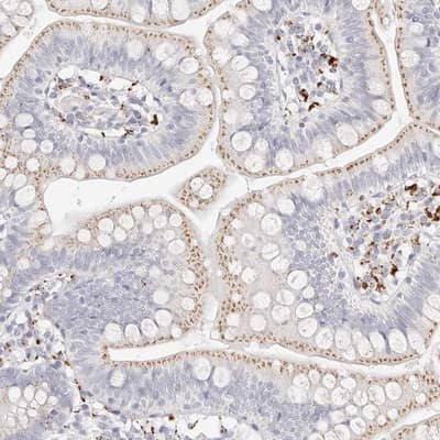 Immunohistochemistry-Paraffin: SgK071 Antibody [NBP1-82686]