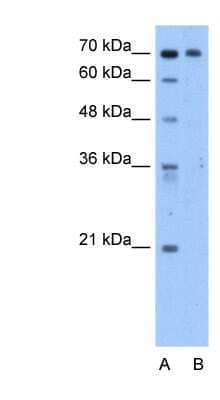 Western Blot: SgK071 Antibody [NBP1-55182]