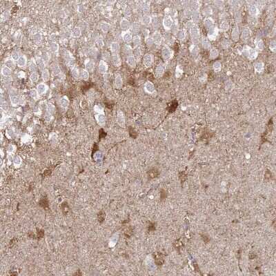 Immunohistochemistry-Paraffin: Shisa-4 Antibody [NBP2-32592]