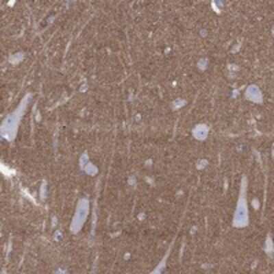 Immunohistochemistry-Paraffin: Shisa-4 Antibody [NBP3-17436]