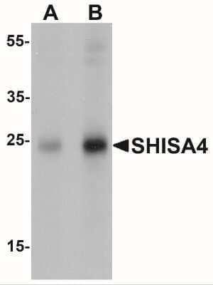 Western Blot: Shisa-4 AntibodyBSA Free [NBP2-22341]