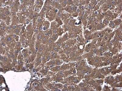 Immunohistochemistry-Paraffin: Shrew-1/AJAP1 Antibody [NBP3-13005]