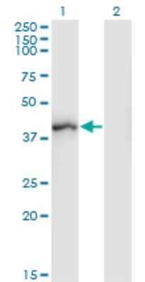 Western Blot: Shugoshin Antibody (3C11) [H00151648-M01]