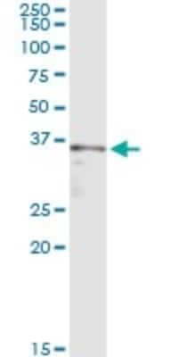 Western Blot: Shugoshin Antibody (4G6) [H00151648-M02]