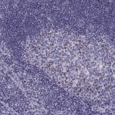 Immunohistochemistry-Paraffin: Shugoshin Antibody [NBP2-55825]
