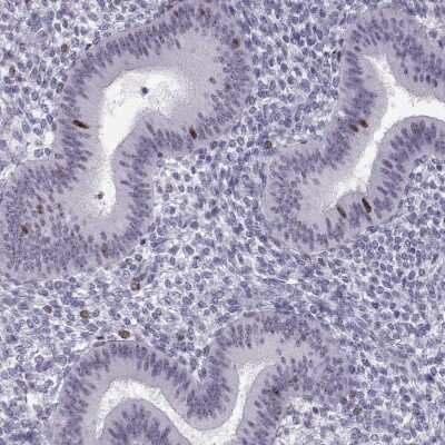 Immunohistochemistry-Paraffin: Shugoshin Antibody [NBP2-55825]