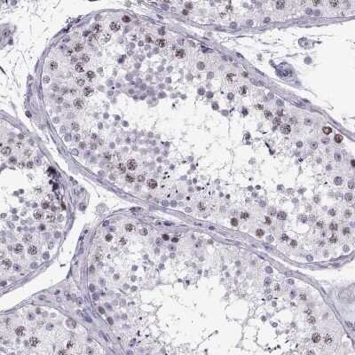 Immunohistochemistry-Paraffin: Shugoshin Antibody [NBP2-55825]