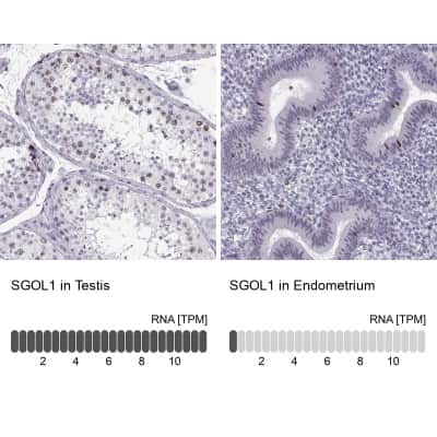 Immunohistochemistry-Paraffin: Shugoshin Antibody [NBP2-55825]