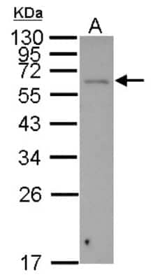 Western Blot: Shugoshin Antibody [NBP2-20355]