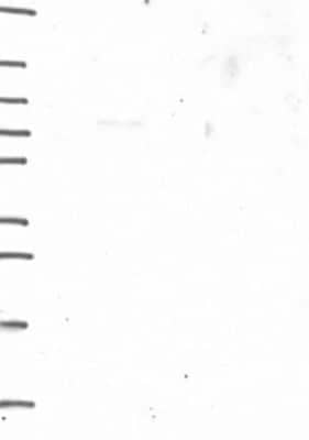 Western Blot: Shugoshin Antibody [NBP3-17932]