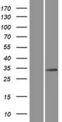 Western Blot: Shugoshin Overexpression Lysate [NBP2-05650]