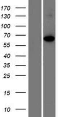 Western Blot: Shugoshin Overexpression Lysate [NBP2-11017]