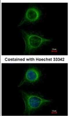 Immunocytochemistry/ Immunofluorescence: Ribosome maturation protein SBDS Antibody [NBP1-32724]