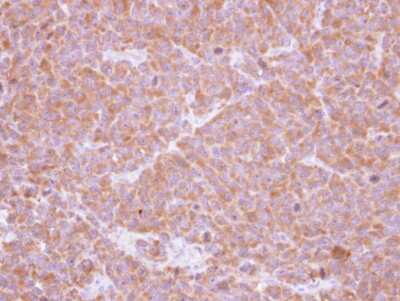 Immunohistochemistry-Paraffin: Ribosome maturation protein SBDS Antibody [NBP1-32724]