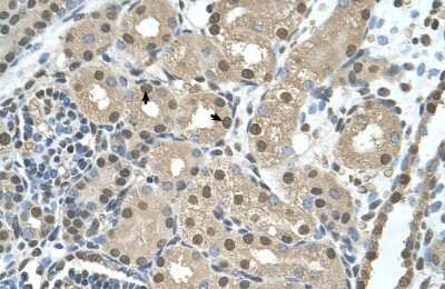 Immunohistochemistry-Paraffin: Ribosome maturation protein SBDS Antibody [NBP1-55131]