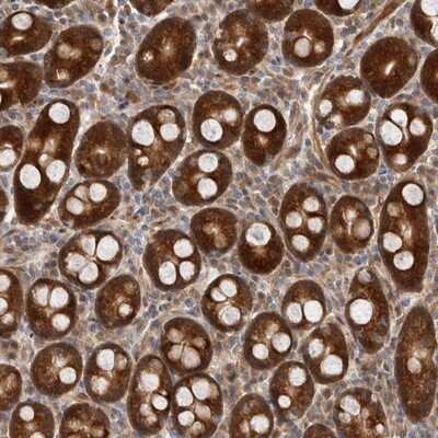 Immunohistochemistry-Paraffin: Ribosome maturation protein SBDS Antibody [NBP1-85646]