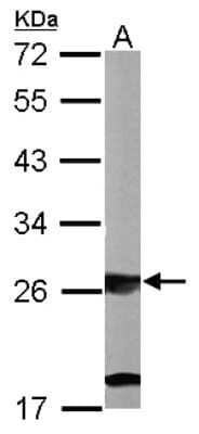 Western Blot: Ribosome maturation protein SBDS Antibody [NBP1-32724]