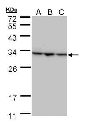 Western Blot: Ribosome maturation protein SBDS Antibody [NBP1-32724]