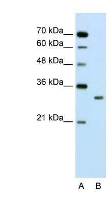 Western Blot: Ribosome maturation protein SBDS Antibody [NBP1-55131]