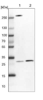 Western Blot: Ribosome maturation protein SBDS Antibody [NBP1-85646]