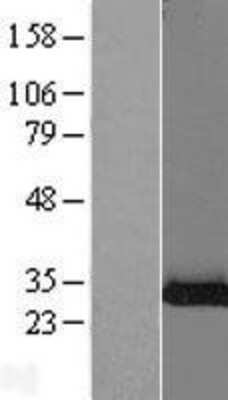 Western Blot: Ribosome maturation protein SBDS Overexpression Lysate [NBL1-15704]