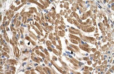 Immunohistochemistry-Paraffin: Sialin/SLC17A5 Antibody [NBP1-59788]