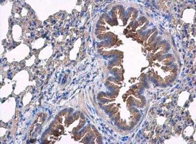 Immunohistochemistry-Paraffin: Sialin/SLC17A5 Antibody [NBP2-20383]