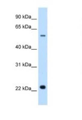 Western Blot: Sialin/SLC17A5 Antibody [NBP1-59788]