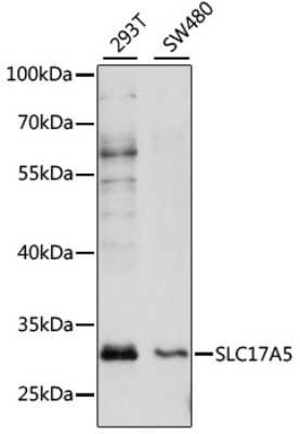 Western Blot: Sialin/SLC17A5 AntibodyAzide and BSA Free [NBP2-94757]