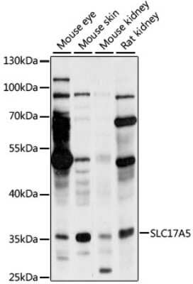 Western Blot: Sialin/SLC17A5 AntibodyAzide and BSA Free [NBP2-94758]