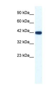 Western Blot: IBSP/Sialoprotein II Antibody [NBP1-70422]