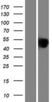 Western Blot: IBSP/Sialoprotein II Overexpression Lysate [NBP2-10516]