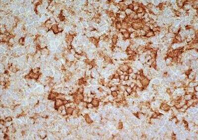 Immunohistochemistry-Frozen: Siglec-1/CD169 Antibody (ED3) - BSA Free [NB100-65301]