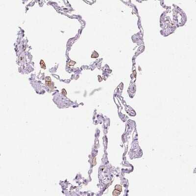 Immunohistochemistry-Paraffin: Siglec-1/CD169 Antibody [NBP2-30903]